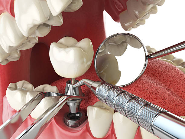 Best Emergency Dental Care for Trauma or Injury in West Hollywood, CA